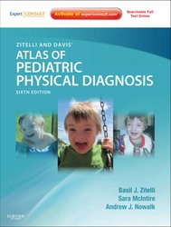 Zitelli and Davis' Atlas Of Pediatric Physical Diagnosis